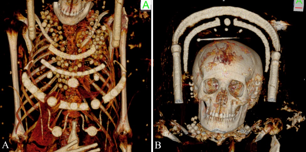 Uno studio multidisciplinare fornisce nuove informazioni sulle tecniche di mummificazione