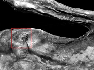 otzi tatuaggi
