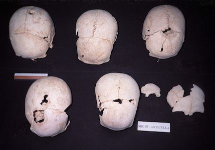 reperti-ossei-archeologici