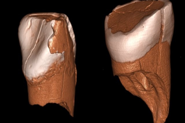 Micro-TC e Analisi DNA confermano convivenza Sapien e Neanderthal in Europa