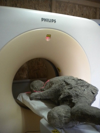 Indagini TAC per studiare i calchi delle vittime dell’eruzione di Pompei
