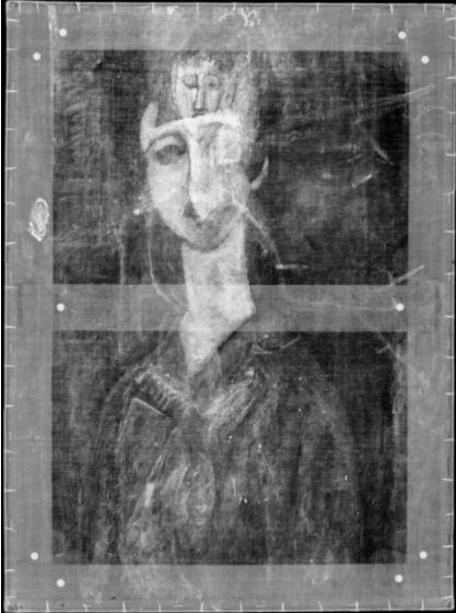 radiografia.JPG