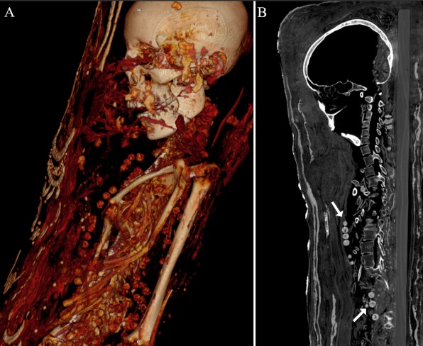 Uno studio multidisciplinare fornisce nuove informazioni sulle tecniche di mummificazione